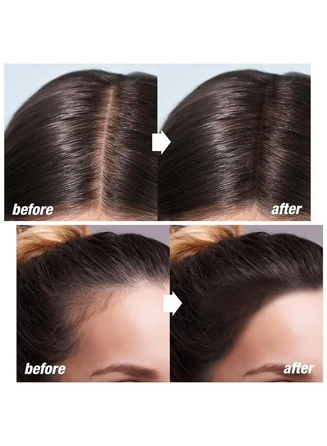 kakashow Hairline Powder, Hair Root Concealer, Instantly Root Cover Up Hairline Cream, Long Lasting Hair Shadow Powder, Hair Concealer For Greys, Thinning Hair, Hair Toppers, Hair Root Dye, Thin Hair Powder (Brown) - Image 4