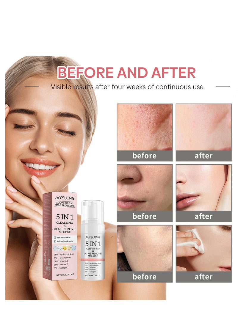 Jaysuing - 5 In 1 Cleansing Acne Remove Mousse, With Hyaluronic Acid Niacinamide Collagen Vitamin , Fast Absorbing Dark Spot Corrector Serum, Anti Wrinkles SerumFor Age Defying Beauty 60ml - Image 1