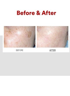 MEDIPEEL Medi-Peel, Melanon X Cream 30ml  - Image 4