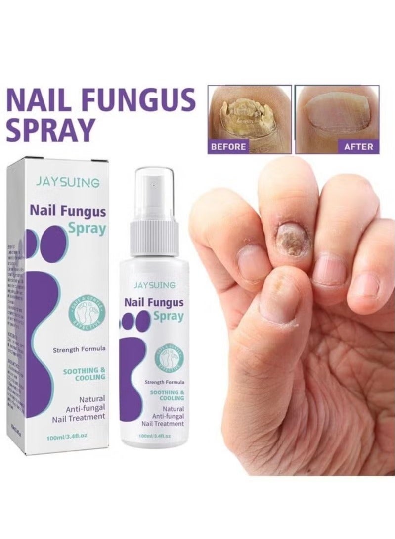 Jaysuing 100ml Effective Anti-Fungal Feet Infections Athlete Foot Nail Fungus Hand And Foot Care Treatment Spray Beauty Health Care - Image 2