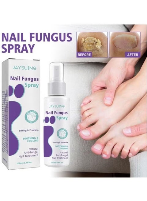 100ml Effective Anti-Fungal Feet Infections Athlete Foot Nail Fungus Hand And Foot Care Treatment Spray Beauty Health Care