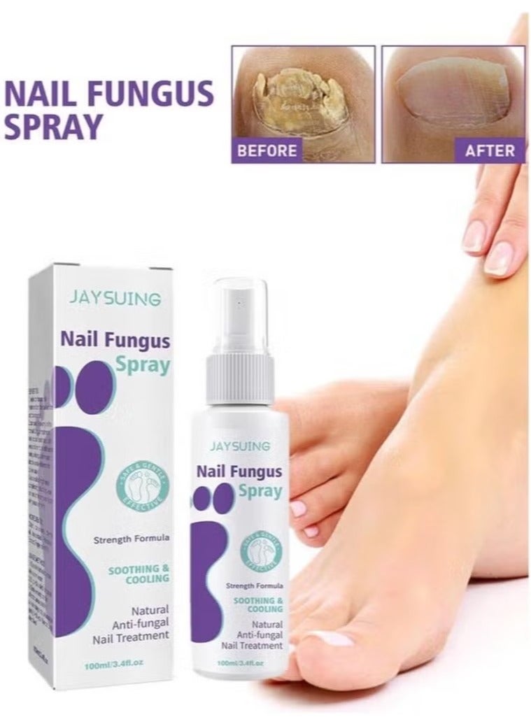 Jaysuing 100ml Effective Anti-Fungal Feet Infections Athlete Foot Nail Fungus Hand And Foot Care Treatment Spray Beauty Health Care - Image 3