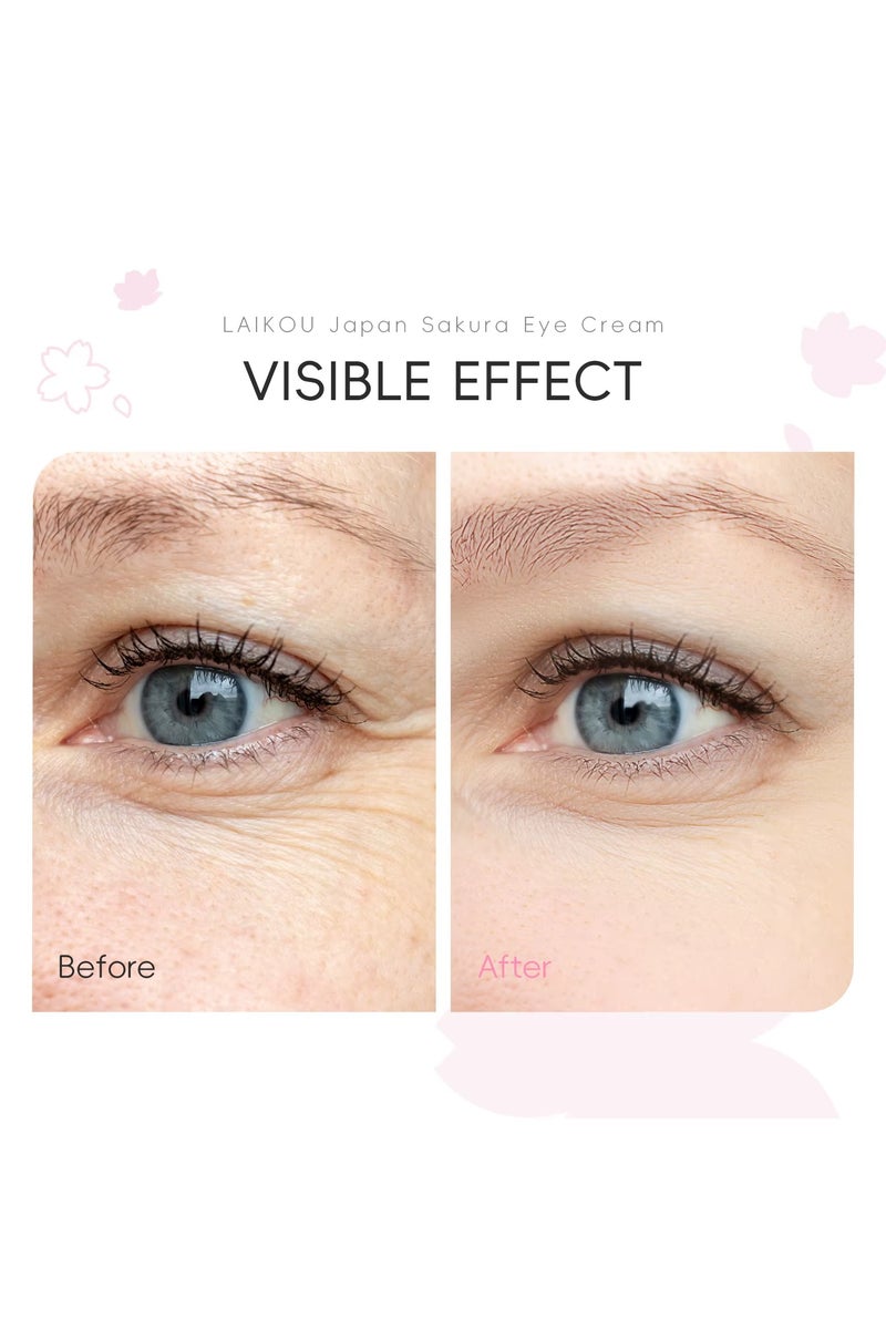 لايكو كريم العين الياباني ساكورا يغذي بشرة العين ويقلل الهالات السوداء وينعم الخطوط الدقيقة وينعم التجاعيد كريم إصلاح العين 30 جرام - Image 2