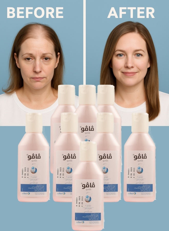 Vavo 8 Pieces Vavo 2% Shampoo 100ML - Image 1