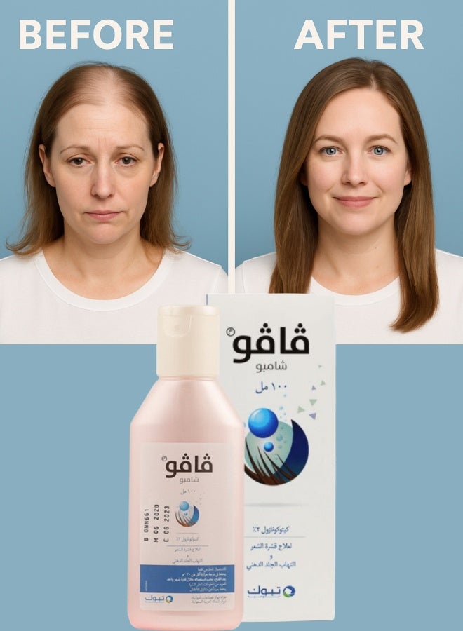 Vavo 8 Pieces Vavo 2% Shampoo 100ML - Image 3