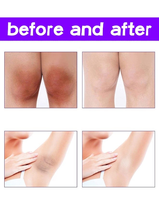 OUHOE Inner Thighs Lightening Cream,Lightening Cream for Dark Skin | Lightening and Whitening Cream for the Intimate Area for Bikini, Sensitive Areas, Underarms, Neck - Image 3