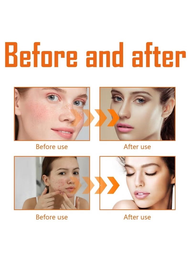 WEST MONTH Turmeric Toner, Exfoliating Toner, Turmeric Face Toner for Dark Spots & Acne, Hydrating Toner for All Skin Types, for Even Tone, Reduces Enlarged, Pores Brightens, Acne-Fighting - Image 5