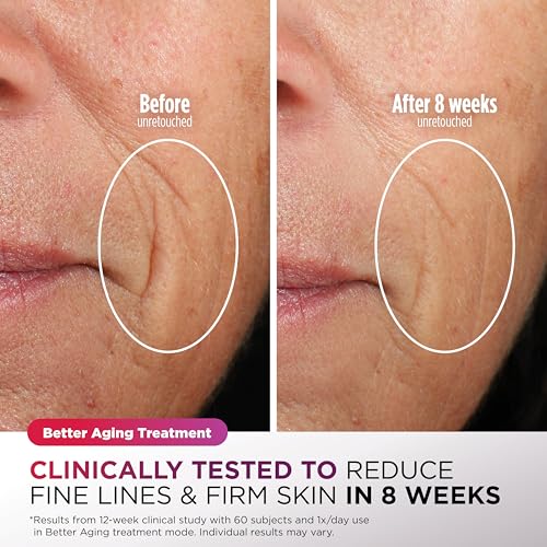 Shark CryoGlow LED Face Mask with Under-Eye Cooling, Anti-Ageing & Blemish Repair, Red & Blue LED, Infrared Light Therapy, USB-C, Remote Control, Storage Bag, Lilac Chill, FW312PL - Image 5