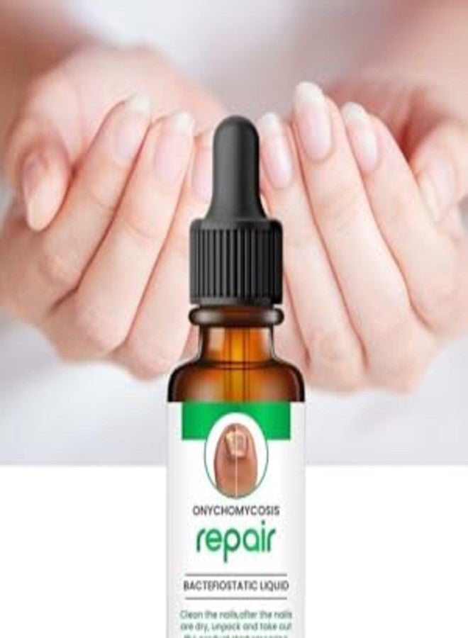 HER HEAL سيروم مضاد للفطريات للأظافر لنمو الأظافر وإصلاحها، تركيبة احترافية، نقي وطبيعي 100%، يغذي الأظافر ويساعد في علاج عدوى فطريات الأظافر، والأظافر التالفة، والأظافر الناشبة - 30 مل (عبوة واحدة) - Image 2