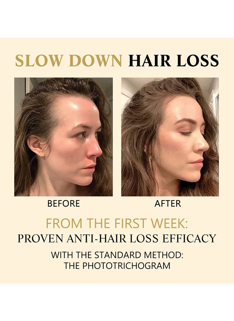 West&Month - Hair Boost Darken Strengthen Essence, Anti Hair Loss Roll On Massage Hair Loss Treatment for Hair Growth, Promote Hair Circulation, Reduce Hair Loss, Restore Thin Hair 20ml - Image 1