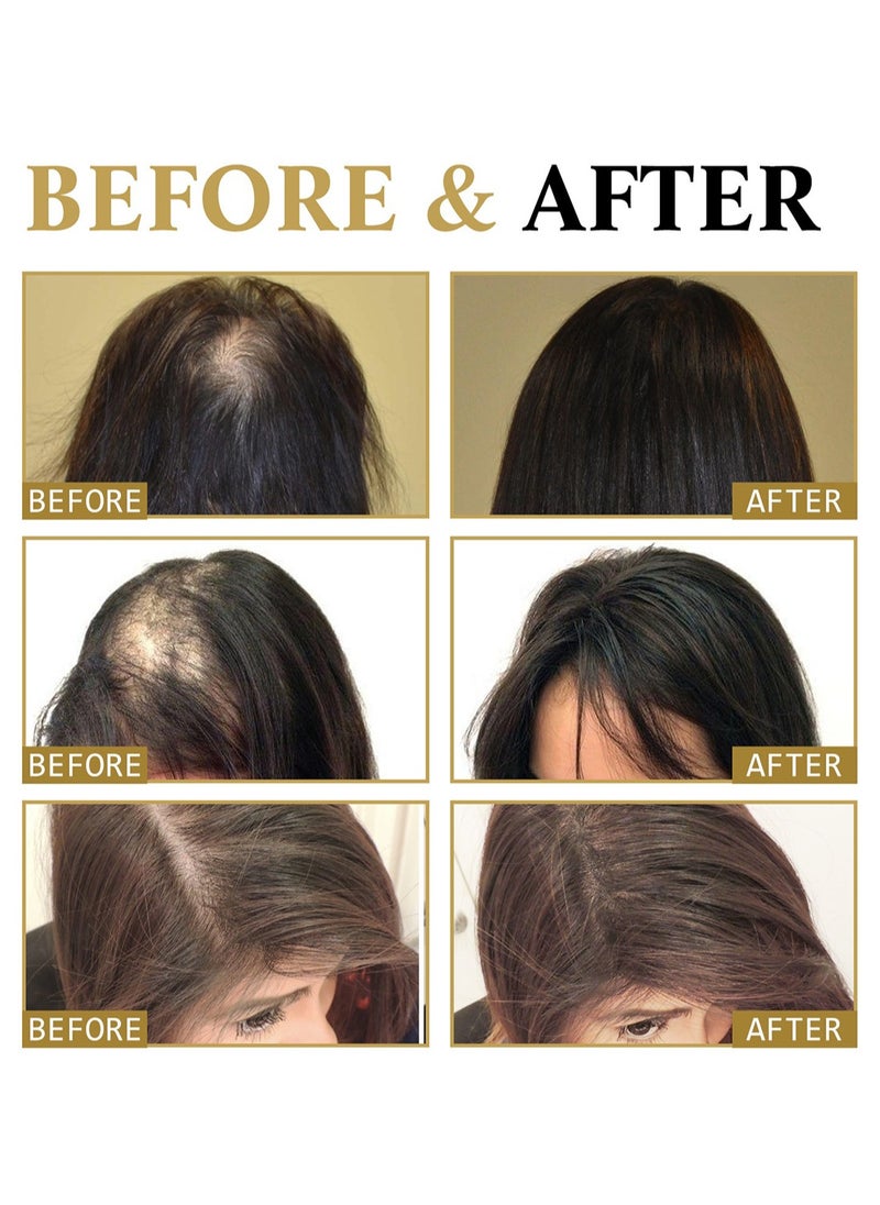 West&Month - Hair Boost Darken Strengthen Essence, Anti Hair Loss Roll On Massage Hair Loss Treatment for Hair Growth, Promote Hair Circulation, Reduce Hair Loss, Restore Thin Hair 20ml - Image 1