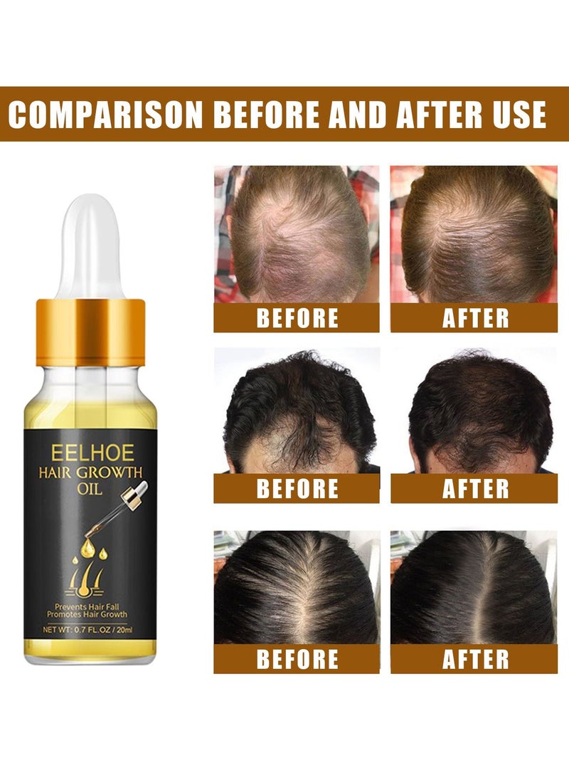 EELHOE - Natural Biotin Hair Growth Oil Serum to Stimulate Hair Regrowth for Thicker Stronger Hair for Men & Women - Image 1