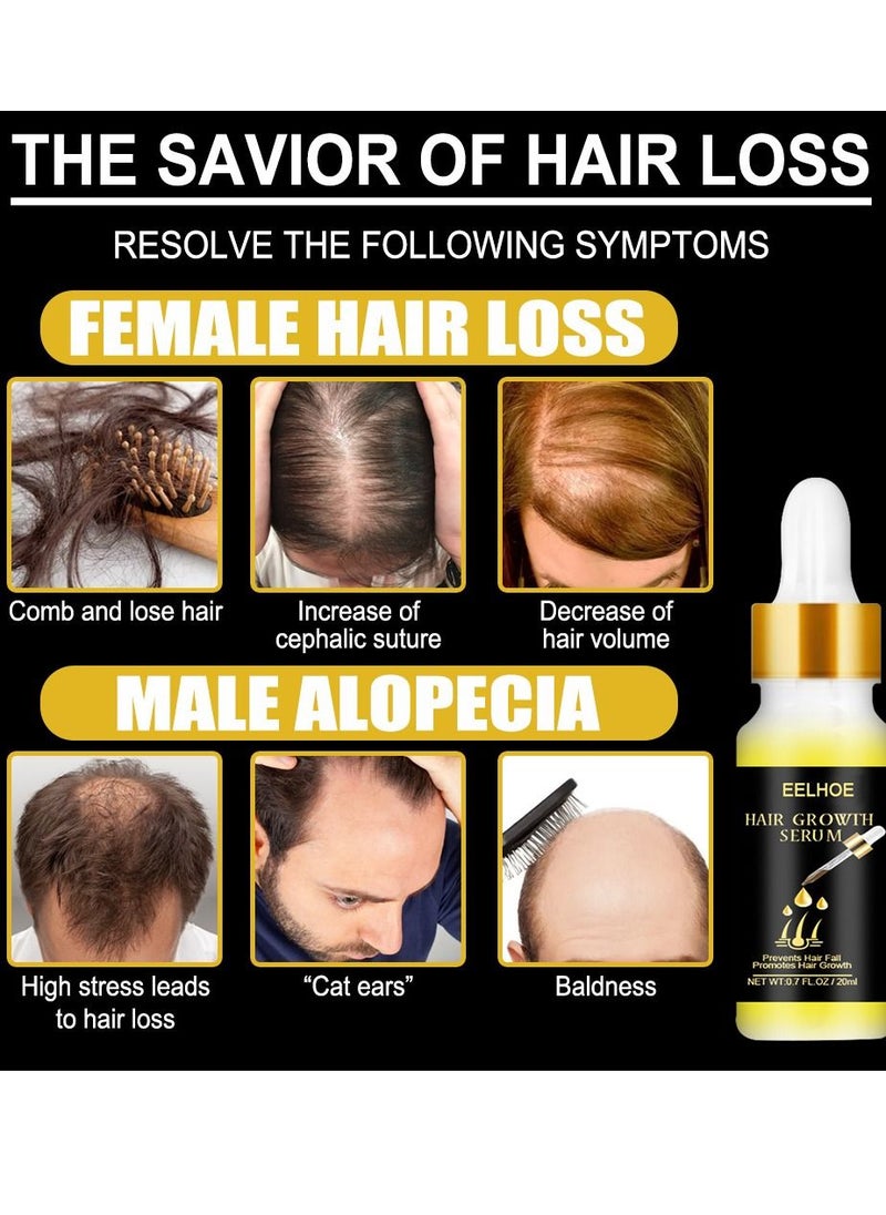 EELHOE - Natural Biotin Hair Growth Oil Serum to Stimulate Hair Regrowth for Thicker Stronger Hair for Men & Women - Image 1