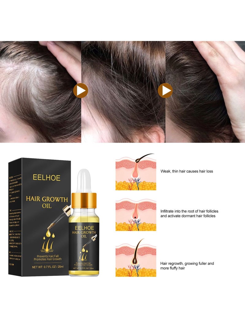 EELHOE - Natural Biotin Hair Growth Oil Serum to Stimulate Hair Regrowth for Thicker Stronger Hair for Men & Women - Image 1