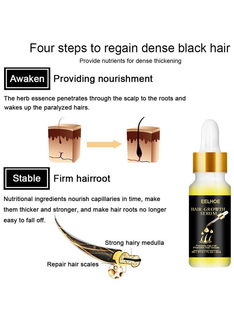 EELHOE - Natural Biotin Hair Growth Oil Serum to Stimulate Hair Regrowth for Thicker Stronger Hair for Men & Women - Image 1