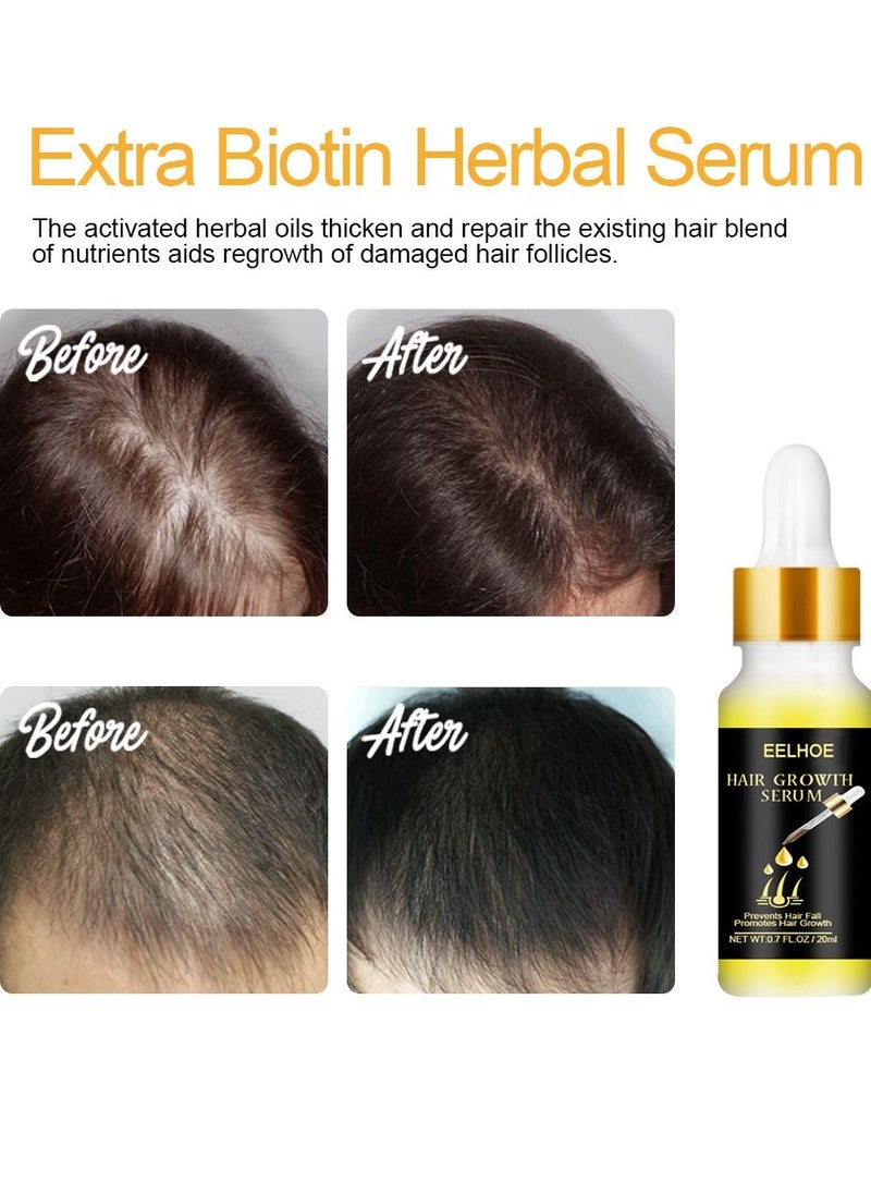 EELHOE - Natural Biotin Hair Growth Oil Serum to Stimulate Hair Regrowth for Thicker Stronger Hair for Men & Women - Image 1