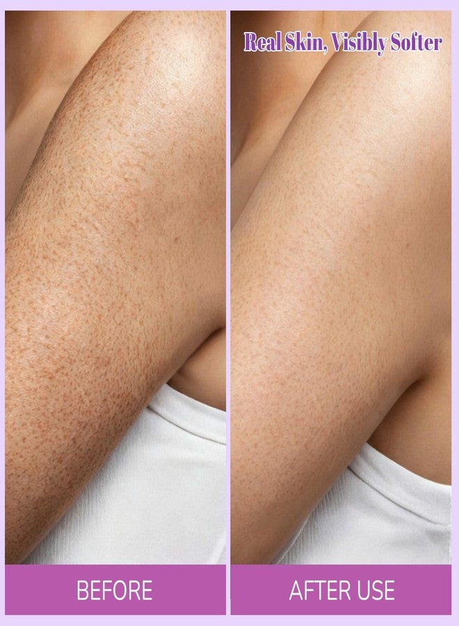 Moulis Glycolic Acid Stick, Glycolic Acid Exfoliating Body Stick for Deep Exfoliation for Rough, Bumpy Skin, Targets KP & Ingrown Hairs, Suitable For All Skin Types (2.65 Ounce (Pack of 1)) - Image 4