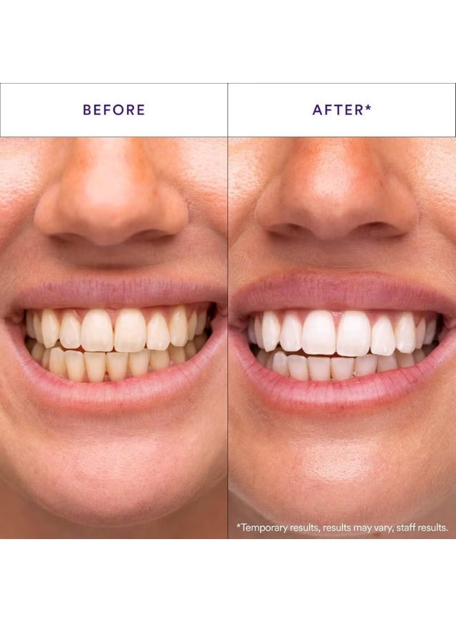 Hismile V34 Whitening Strips - Teeth Whitening Strips with Colour Correction Technology - Image 2