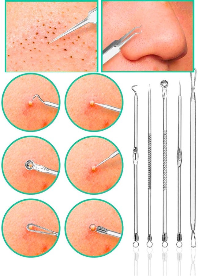Chase Up Blackhead Remover Pimple Popper Tool Kit, 8 PCS Acne Blemish Pimple Extractor Needle, Facial Comedone Clip, Blackhead Tweezer, for Ingrown Hair Removal in Metal Case - Image 3