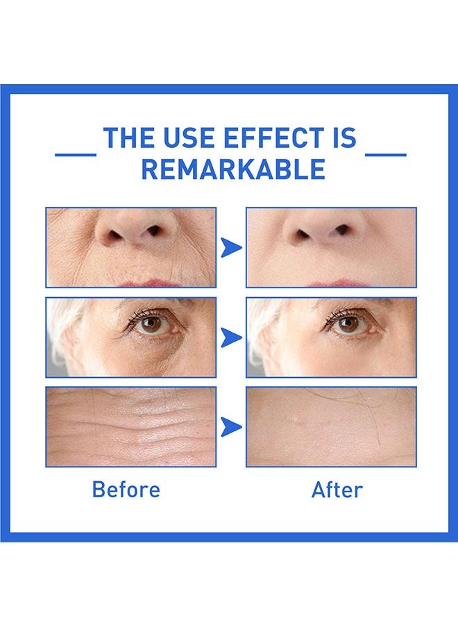 West&Month Botox Stock Solution Anti Aging Serum 30ml, Reduce Wrinkles, Plump Skin, Firm Face, Hyaluronic Acid Face Serum for All Skin Types, Vitamin C Serum for Men and Women - Image 4