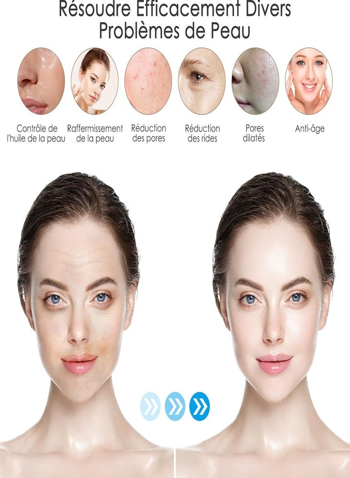 دي آر. بن مجموعة أقلام دكتور بن ألتيما A10 ذات الإبر الدقيقة - أحدث قلم إبر دقيقة لعلاج ندبات حب الشباب - قلم لاسلكي للبشرة - قلم سحري للبشرة للوجه والجسم - 22 خرطوشة (10 قطع 12 إبرة + 10 قطع 36 إبرة) - Image 3