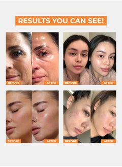 Face Fresh Vitamin C Ampoule Face Serum - Hyaluronate & Niacinamide, Reduces Dark Spots & Discoloration, Brightens & Improves Skin Texture, For All Skin Types 5ml  - Image 2