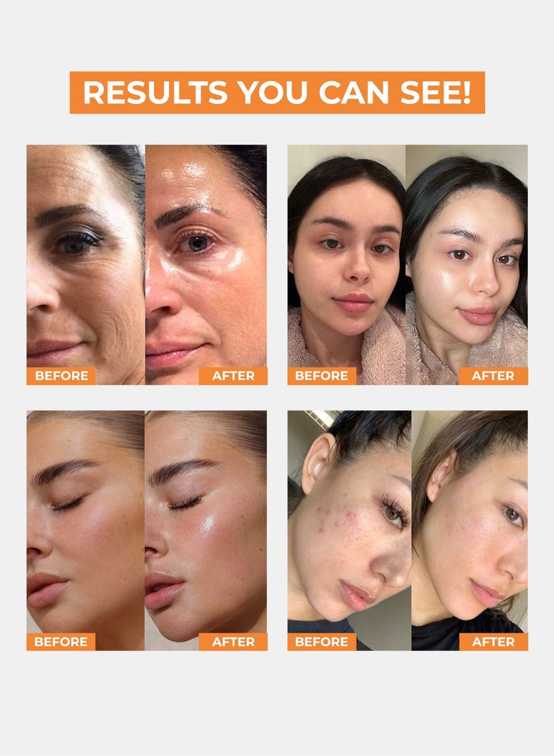 Face Fresh Vitamin C Ampoule Face Serum - Hyaluronate & Niacinamide, Reduces Dark Spots & Discoloration, Brightens & Improves Skin Texture, For All Skin Types 5ml  - Image 2