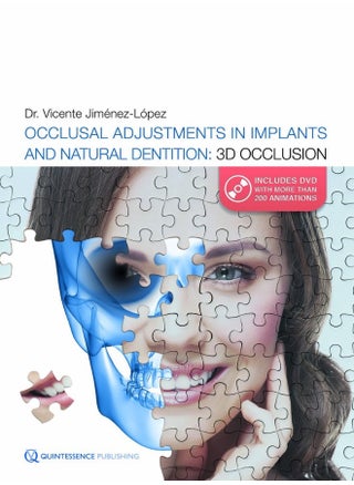 Occlusal Adjustments in Implants and Natural Dentition: 3D Occlusion - pzsku/Z1EC67AD9D76EBE73F1C4Z/45/_/1724847673/0fa1dea9-9cb7-4602-823a-5315d92d8a7b