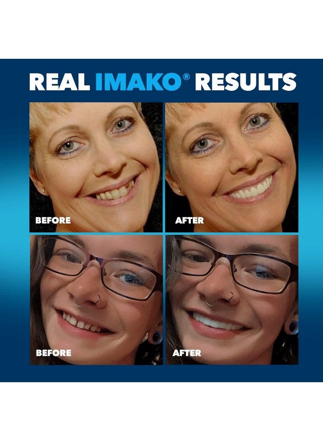 Imako Premium Cosmetic Upper- 1 Pack - Large, Bleached White - DIY Smile Makeover - Made in USA - Image 3