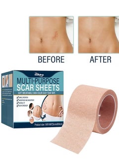 SOUTH MOON Multi Purpose Scar Sheets Soft Breathable Skin Color Easy Tear Tape,Complexion Concealer Patches , Skin Scar Tattoos Acne Scar Patches -,Waterproof Complexion Patches  - Image 1