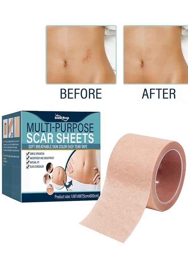 SOUTH MOON Multi Purpose Scar Sheets Soft Breathable Skin Color Easy Tear Tape,Complexion Concealer Patches , Skin Scar Tattoos Acne Scar Patches -,Waterproof Complexion Patches  - Image 1