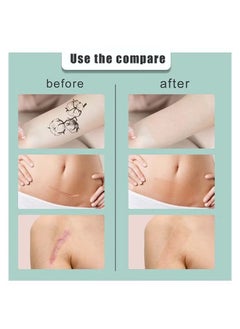 SOUTH MOON Multi Purpose Scar Sheets Soft Breathable Skin Color Easy Tear Tape,Complexion Concealer Patches , Skin Scar Tattoos Acne Scar Patches -,Waterproof Complexion Patches  - Image 4