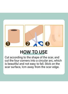 SOUTH MOON Multi Purpose Scar Sheets Soft Breathable Skin Color Easy Tear Tape,Complexion Concealer Patches , Skin Scar Tattoos Acne Scar Patches -,Waterproof Complexion Patches  - Image 5