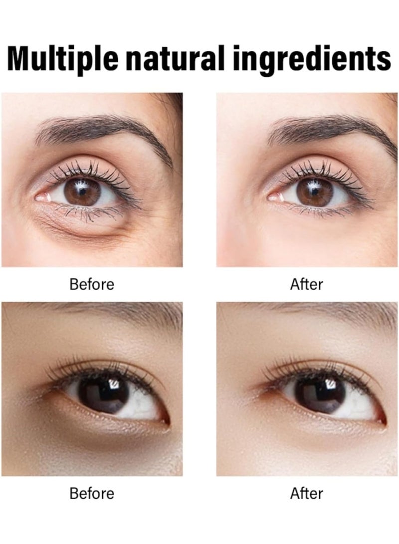 مويكا 2 قطعة كريم ريتينول للعين للهالات السوداء والانتفاخ - علاج مضاد للشيخوخة للمساعدة في تقليل الخطوط الدقيقة وأكياس العين وتفتيح البشرة - كريم ترطيب التجاعيد اليومي - 30 جم * 2 - Image 4