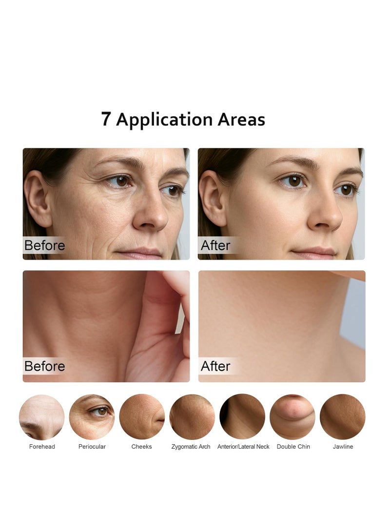 general 7 in 1 Multifunctional Facial Massager, Red Light Therapy for Face, Beauty Skin Care Tool for Face and Neck, Portable Facial Massager for Wrinkles and Skin Care-White - Image 4