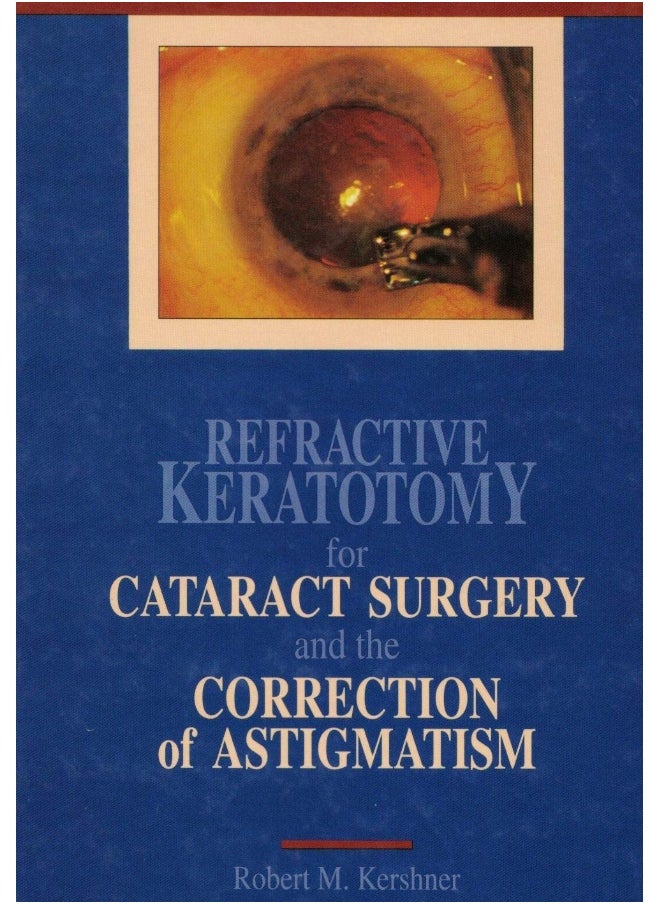 Refractive Keratotomy for Cataract Surgery and the Correction of Astigmatism 