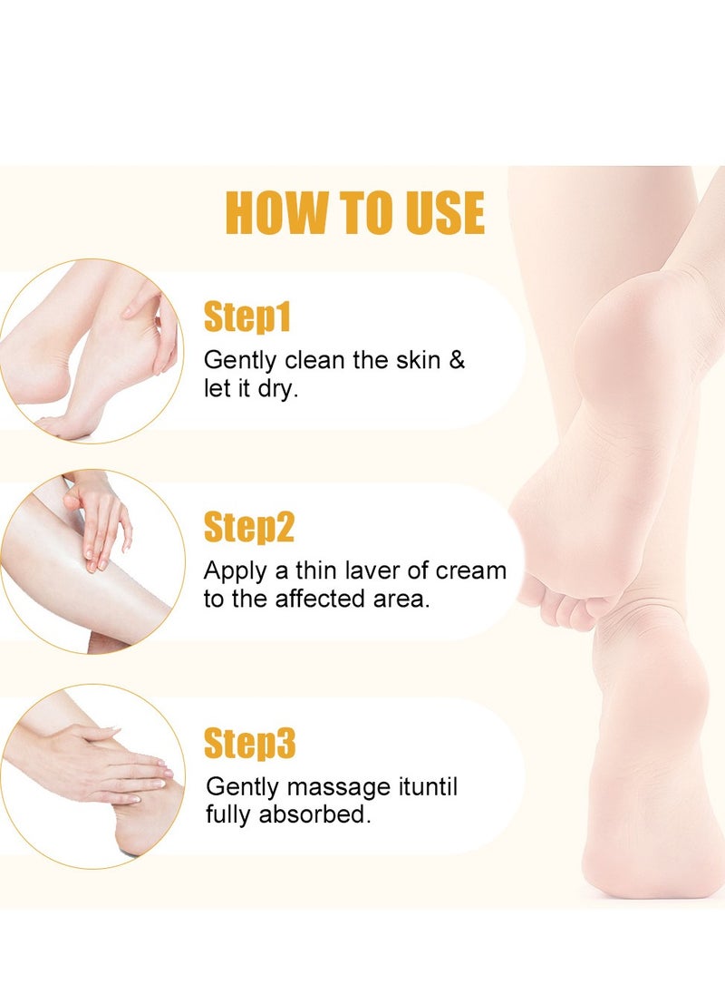 LANEMAY - Urea Cream 60 Percent for Feet Maximum Strength with 2% Salicylic Acid, Callus Remover, Dead Skin Exfoliation, Hand and Foot Cream for Dry Cracked Hands,Elbows, Feet, Heels, Knees - Image 1