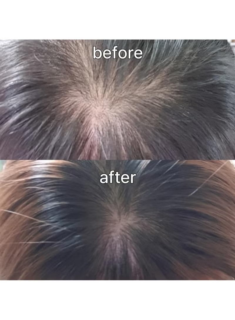 ViveLab Scalp&Hair Serum for Thinning Hair,15ml–Clinically Tested,Nourishing Formula with Biotin,peptide. Promotes Healthy Scalp&Fuller-Looking Hair - Image 5