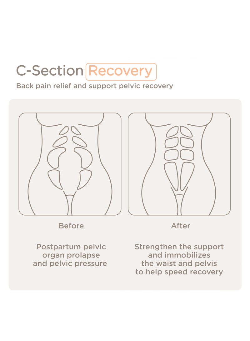 3 in 1 Postpartum Belt - Breathable Postpartum Recovery Postnatal Corset Belt after Pregnancy Maternity, Light skin-L