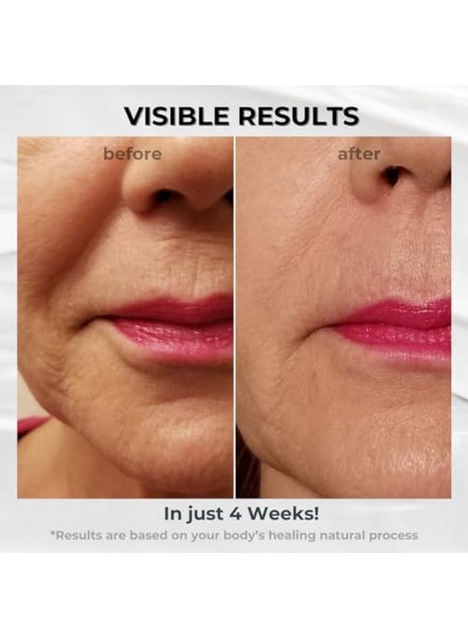 BIONOVA - Anti-Aging Nose-to-Mouth Wrinkle Treatment Cream With UV Chromophores, Supports Cell Renewal, Boosting Elasticity and Skin Radiance 0.5 oz - Image 4