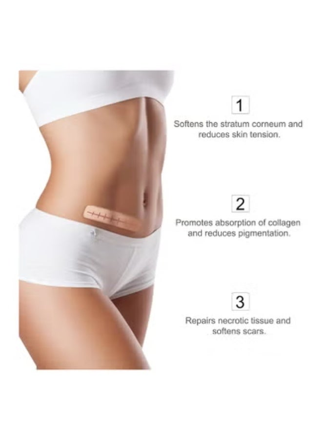 سيليكون صفائح سيليكون لإزالة الندبات (لفافة 1.6 بوصة × 120بوصة - 3 أمتار)، لفافة شريط سيليكون لإزالة الندبات، شرائط سيليكون لإزالة الندبات، قابلة لإعادة الاستخدام، صفائح احترافية لإزالة الندبات للولادة القيصرية، الجراحة، الحروق، الجدرة، حب الشباب وما إلى ذلك. - Image 3