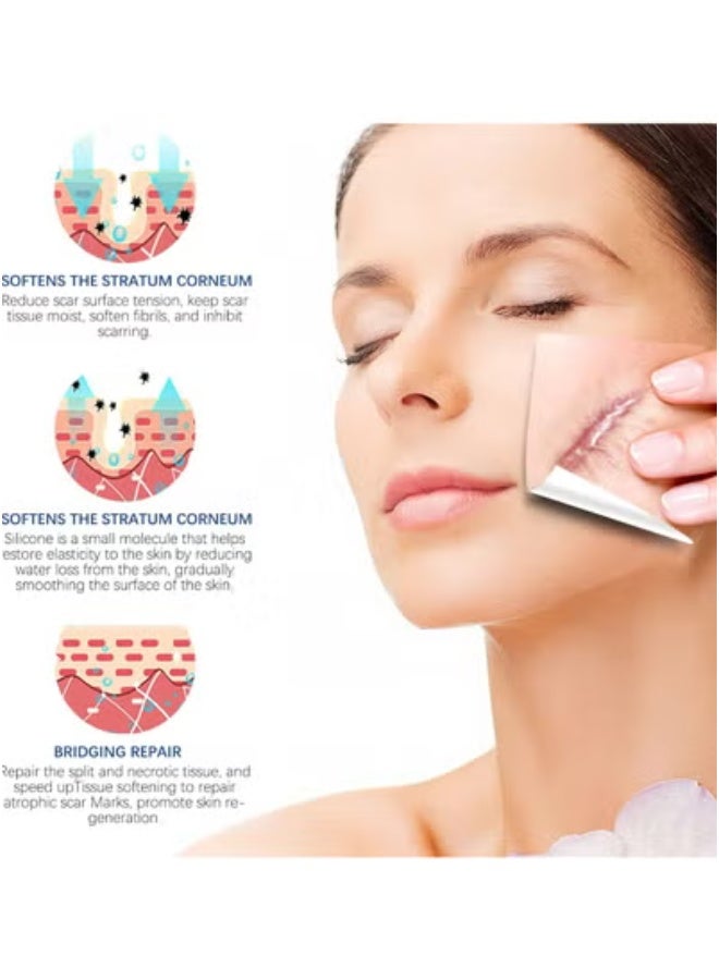 سيليكون صفائح سيليكون لإزالة الندبات (لفافة 1.6 بوصة × 120بوصة - 3 أمتار)، لفافة شريط سيليكون لإزالة الندبات، شرائط سيليكون لإزالة الندبات، قابلة لإعادة الاستخدام، صفائح احترافية لإزالة الندبات للولادة القيصرية، الجراحة، الحروق، الجدرة، حب الشباب وما إلى ذلك. - Image 2