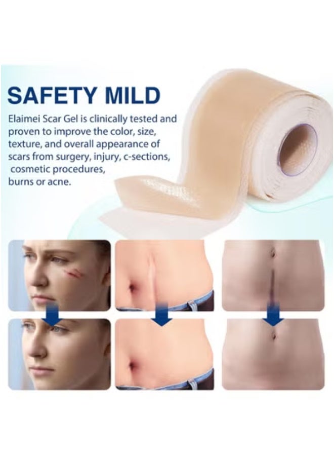سيليكون صفائح سيليكون لإزالة الندبات (لفافة 1.6 بوصة × 120بوصة - 3 أمتار)، لفافة شريط سيليكون لإزالة الندبات، شرائط سيليكون لإزالة الندبات، قابلة لإعادة الاستخدام، صفائح احترافية لإزالة الندبات للولادة القيصرية، الجراحة، الحروق، الجدرة، حب الشباب وما إلى ذلك. - Image 5