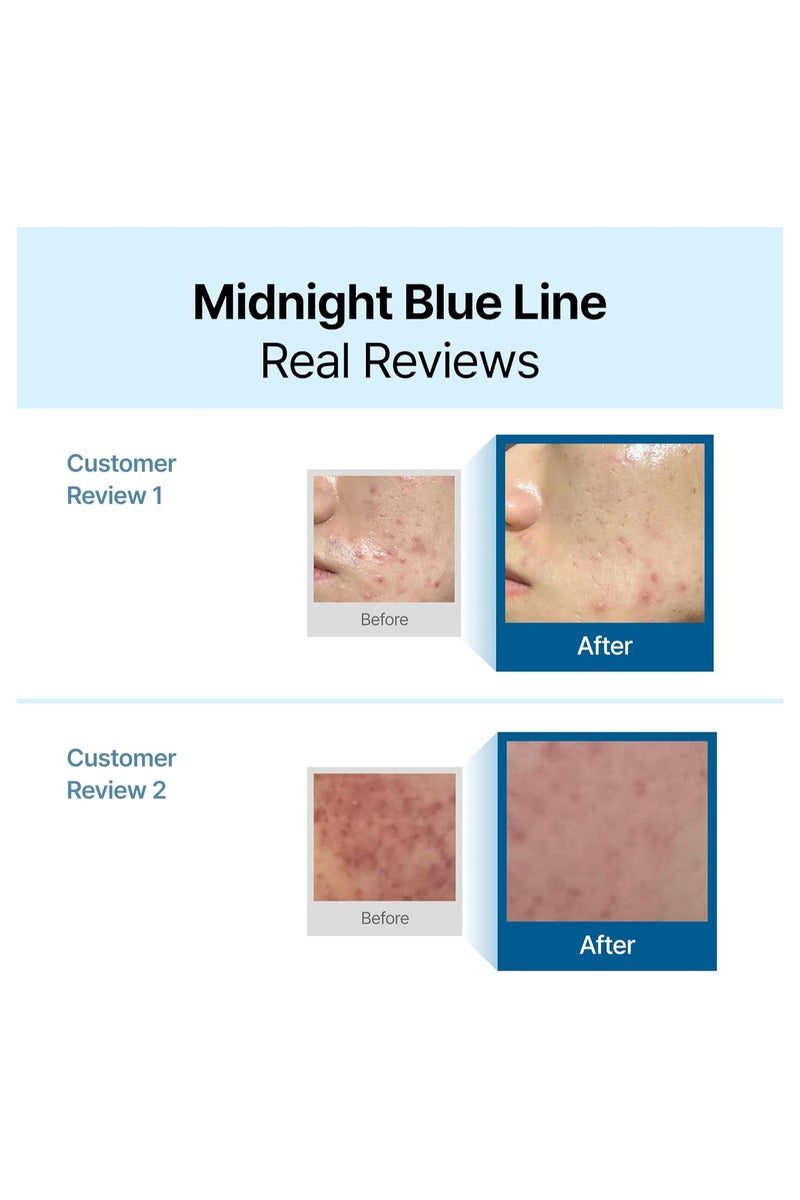 Klairs Midnight Blue Calming Cream 60ml - Image 3