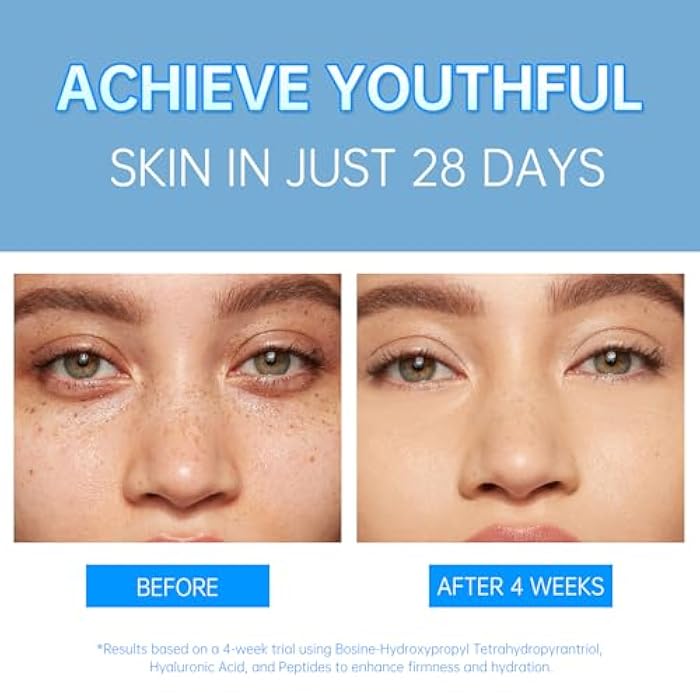 VGO Pro-Xylane Active Cream - Plumping & Firming, Daily Face Repair Moisturizer Hydrating for All Skin Types 30g / 1.02oz - Image 5