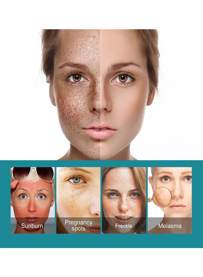 إيلهو كريم إزالة البقع السوداء 20 مل ، كريم إزالة البقع السوداء لمكافحة الشيخوخة ، والحد من ظهور البقع السوداء مع مرور الوقت ، وترطيب سطح الجلد على نحو سلس - Image 5