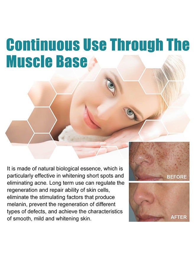 إيلهو كريم إزالة البقع السوداء 20 مل ، كريم إزالة البقع السوداء لمكافحة الشيخوخة ، والحد من ظهور البقع السوداء مع مرور الوقت ، وترطيب سطح الجلد على نحو سلس - Image 3