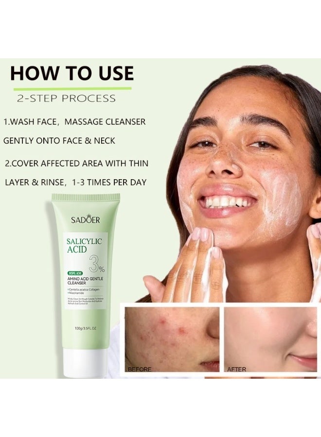 SADOER 100g Salicylic Acid Amino Acid Gentle Cleanser Dispel Acne Treatment Salicylic Acid Facial Cleanser Face Wash Foam Face Cleanser Moisturizing Facial Cleansing Hydrating Skin Care Face Cleanser - Image 5