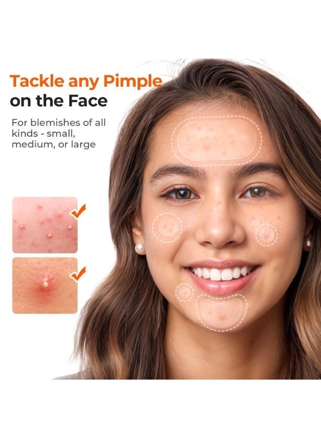 OUHOE 443 Count Pimples Patches in 5 Sizes for Pimples and Clusters of Acne, Hydrocolloid Acne Patch, Acne Stickers for Covering Cheeks, Forehead, Chin Blemishes Zit Breakouts for All Skin Types - Image 4