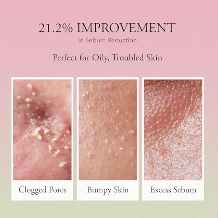 APRILSKIN Pink Aloe Vita Toner | Calms and Soothes Redness, Smoothens, and Controls Excess Sebum | 80% Pink Aloe Vera Water | Hydrating, Non-Sticky | Clean & Vegan Korean Skin Care (8.45 fl.oz) - Image 4